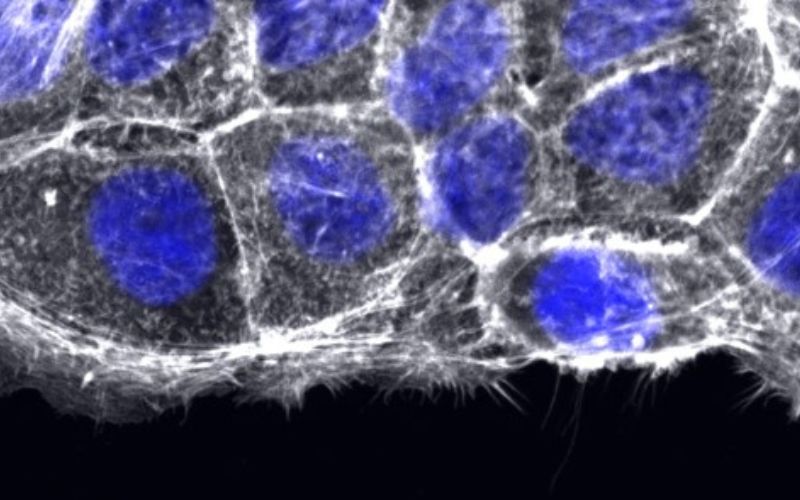 hunman lung cells with blue stain