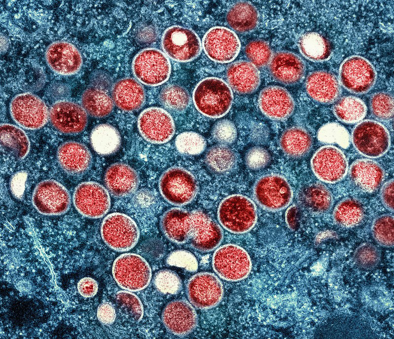 Microscopy image showing monkeypox particles, colored red, within an infected cell, colored blue