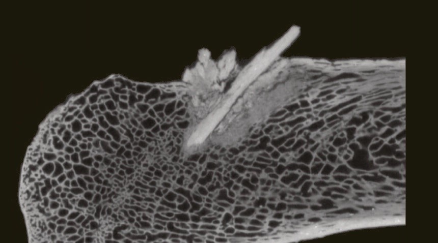 CT scan of bone-point fragments embedded in a mastodon rib